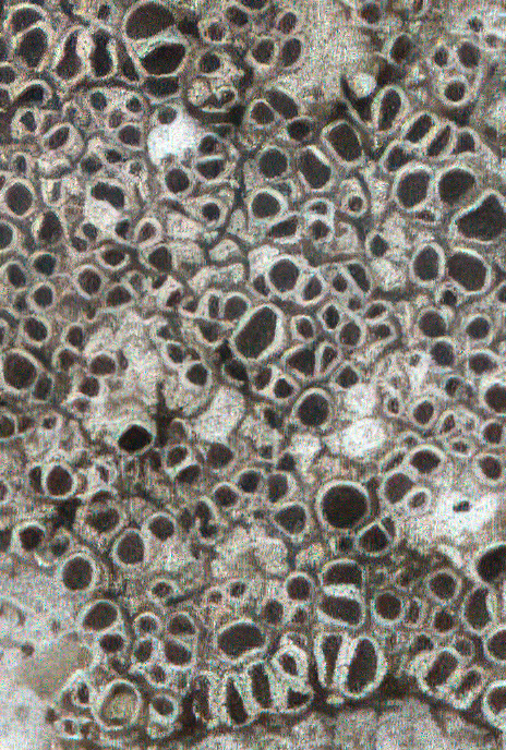Lecanora gangaleoides